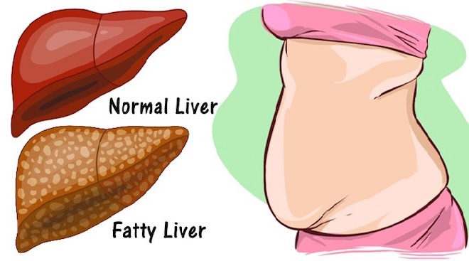fatty liver inmarathi