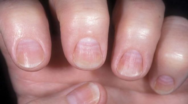 nails inmarathi